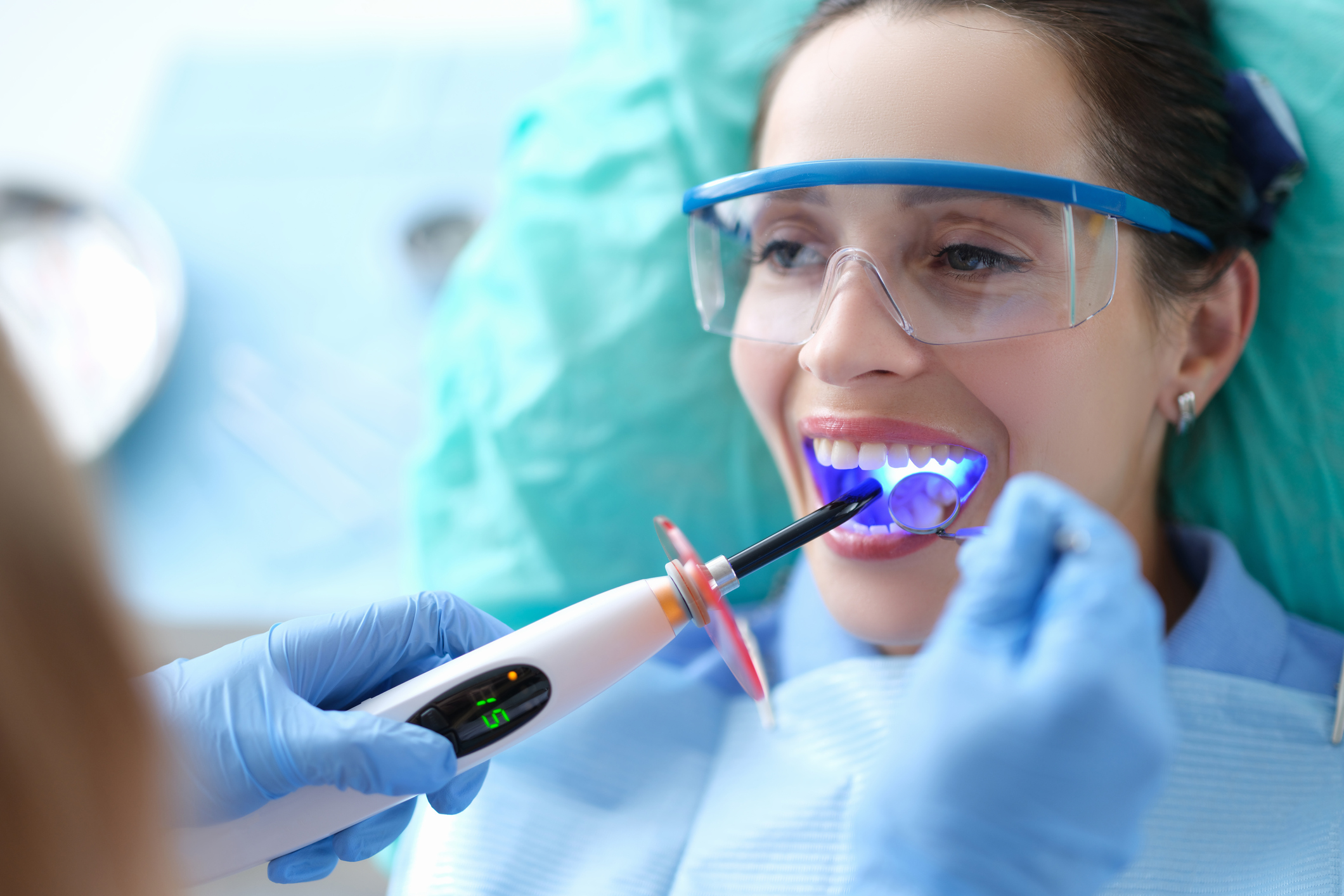 Dental Bonding vs. Porcelain Veneers Columbia SC