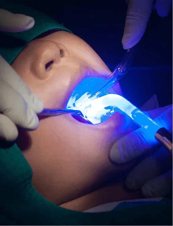 Dental Bonding Columbia SC